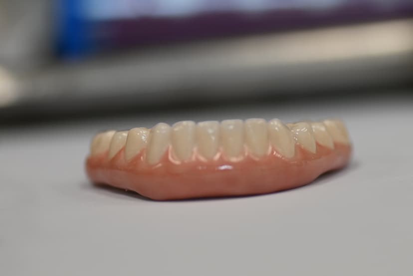 Implant Denture 1