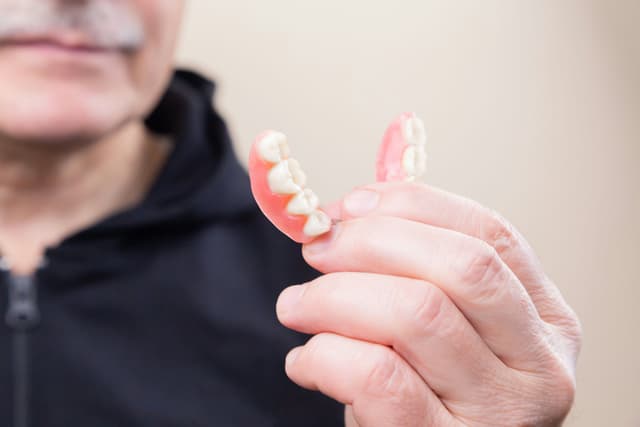 Removable Partials and Dentures image